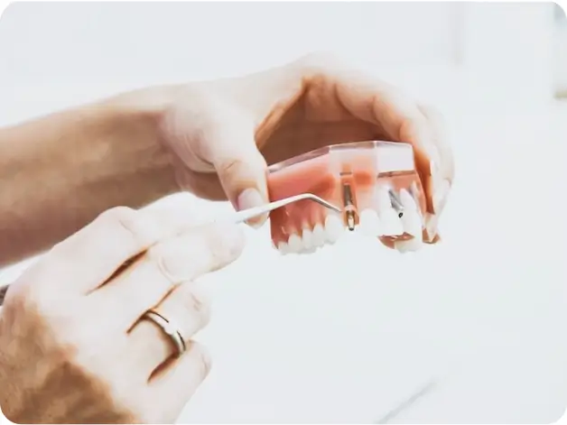 implant